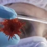 【文獻精度】蛋白組+三代全長轉(zhuǎn)錄組致力于腫瘤標(biāo)志物的研究